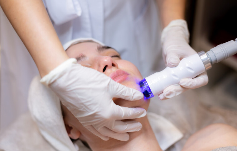 Facial Laser Hair Removal