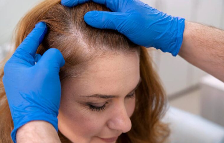 A Comprehensive Guide to Non-Surgical Hair Replacement