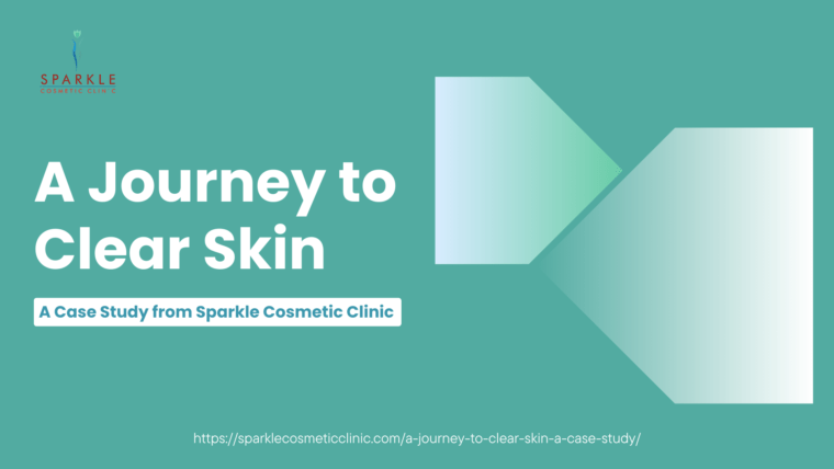 A Journey to Clear Skin: A Case Study from Sparkle Cosmetic Clinic