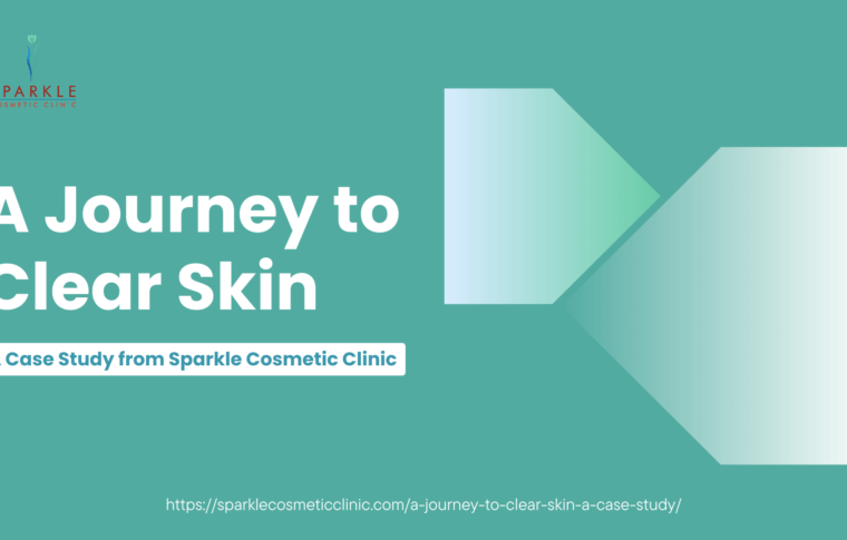 A Journey to Clear Skin: A Case Study from Sparkle Cosmetic Clinic