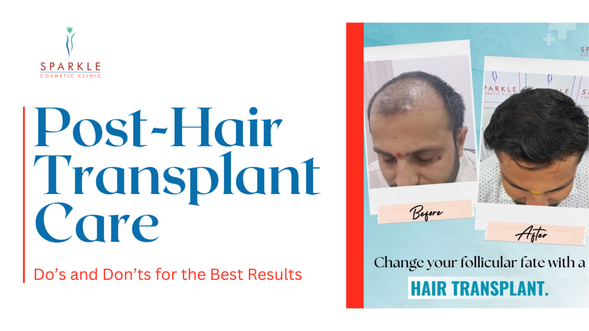 Post-Hair Transplant Care: Dos and Don’ts for the Best Results