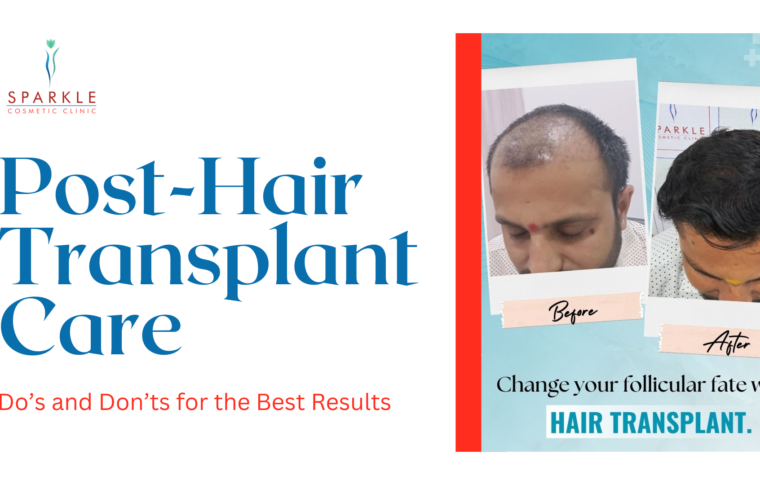 Post-Hair Transplant Care: Dos and Don’ts for the Best Results