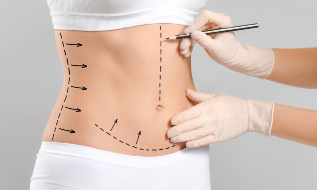 Liposuction in Mumbai