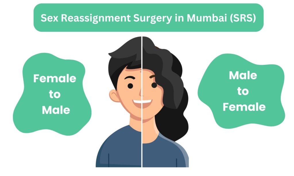 Sex Reassignment Surgery in Mumbai (SRS)