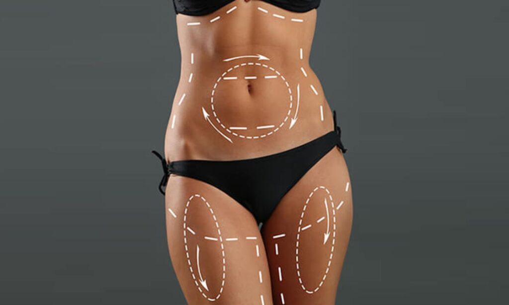 tummy tuck in Mumbai