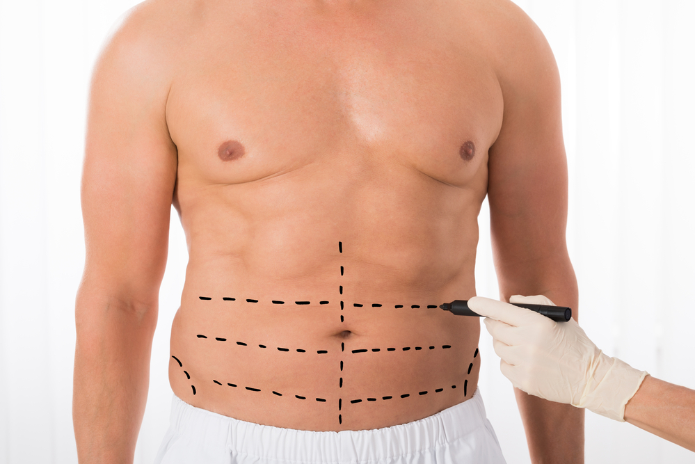 Liposuction in Mumbai