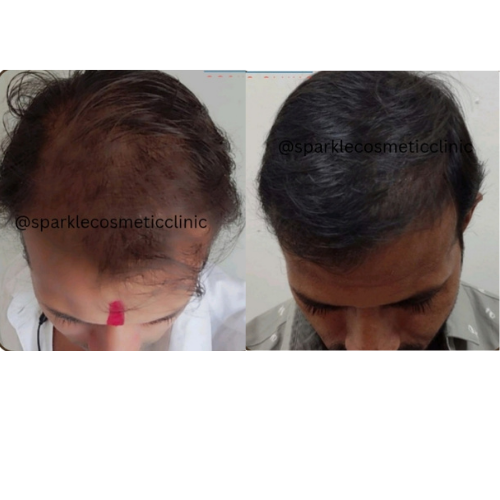 Hair Strengthening Therapy​