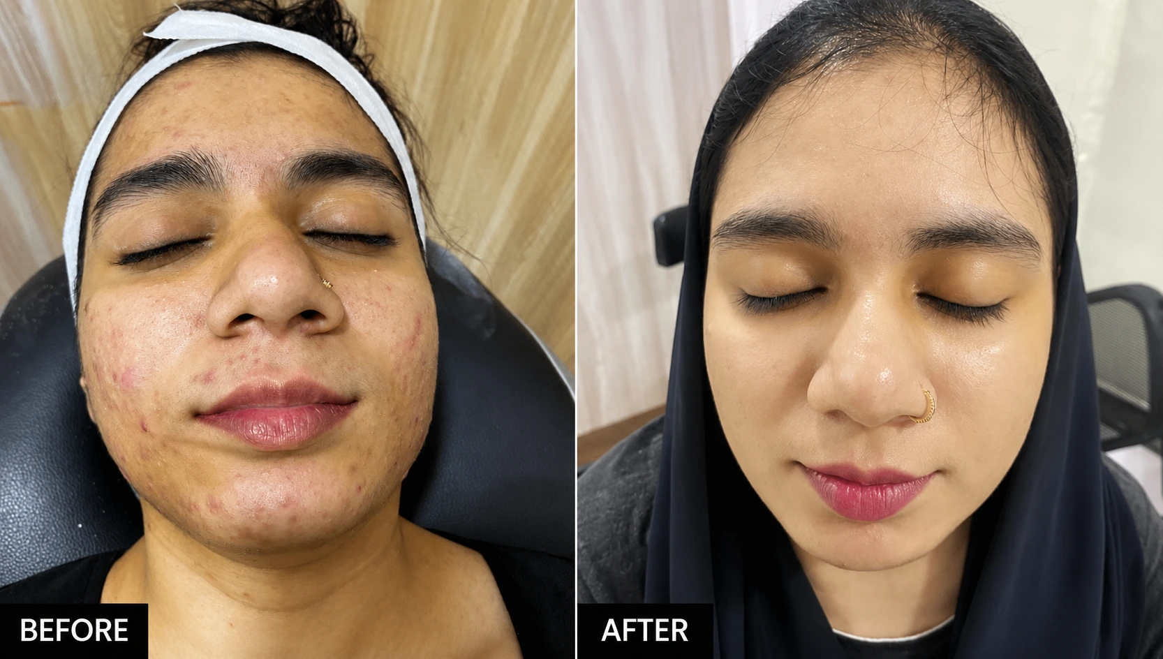 Sparkle Cosmetic Clinic | Skin, Hair & Laser Treatments in Mira Road, Mumbai