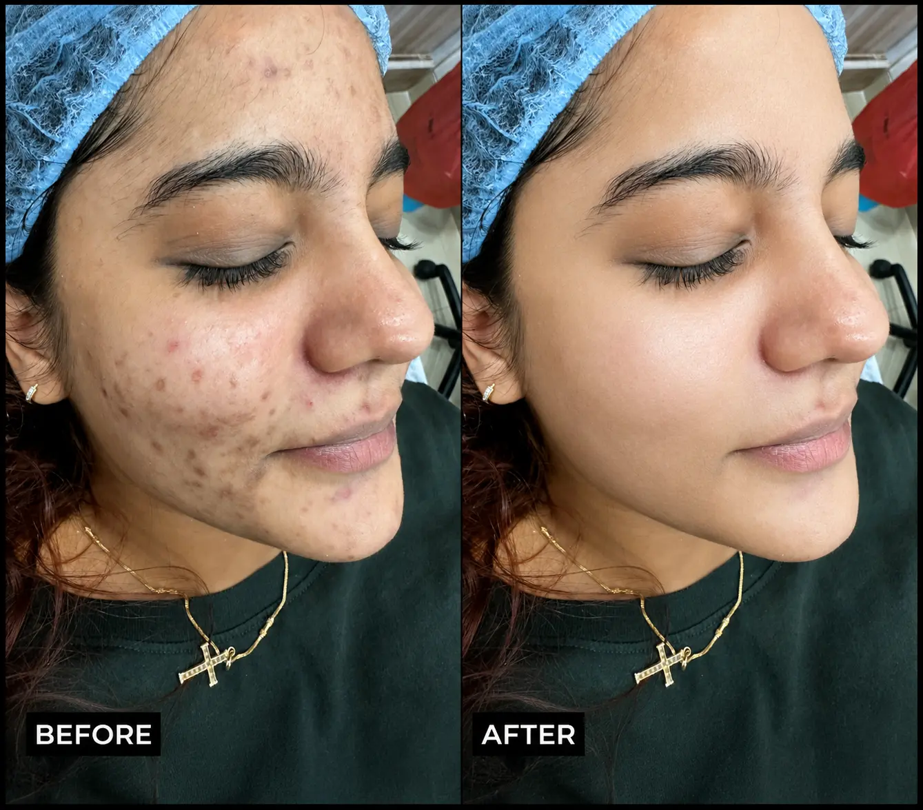 Sparkle Cosmetic Clinic | Skin, Hair & Laser Treatments in Mira Road, Mumbai
