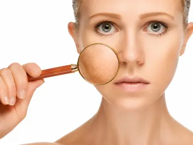Cosmetic Treatment-Pigmentation Correction in mira road mumbai