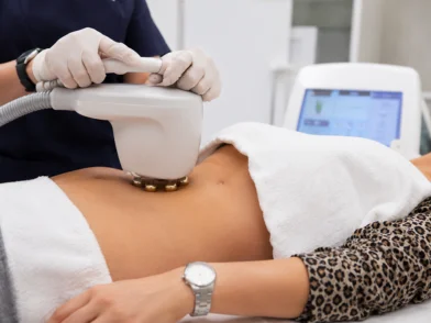 Laser treatment - Cellulite Reduction Therapy in mira road mumbai