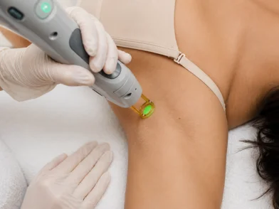 Laser treatment - Underarm Laser Treatment in mira road mumbai