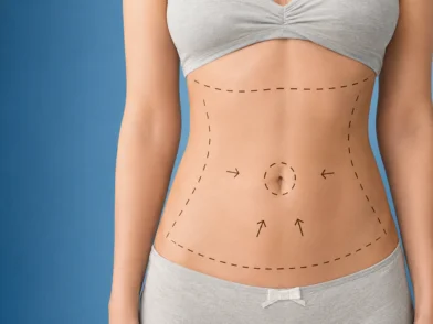 Plastic Surgery-Abdominoplasty Treatment in mira road mumbai