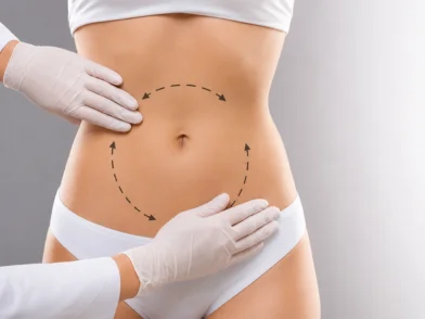 Plastic Surgery-Tummy Tuck Surgery in mira road mumbai