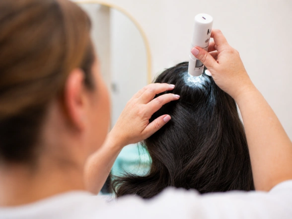 Scalp Health Treatment - sparkle cosmetic Hair Transplant clinic in miraroad, mumbai
