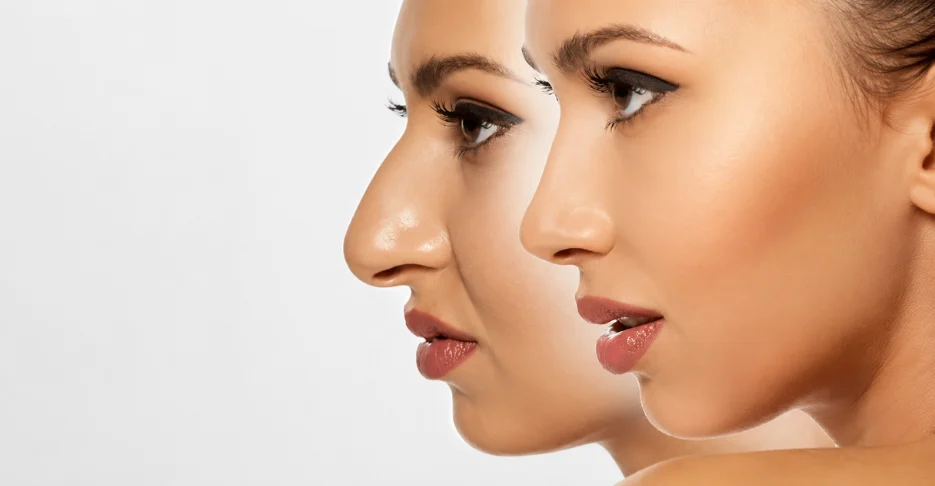 best Rhinoplasty Treatment expert in mira road mumbai