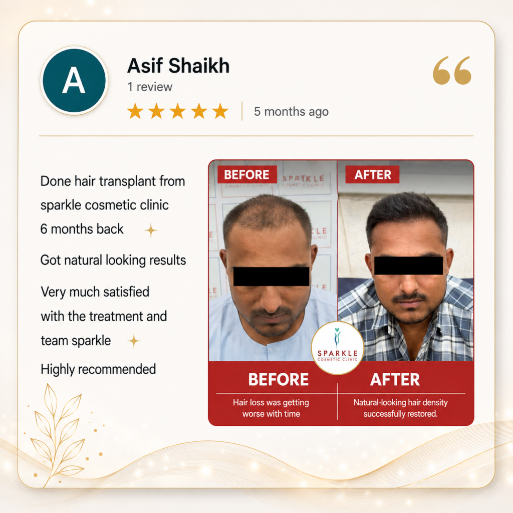 hair transplant real result in mumbai