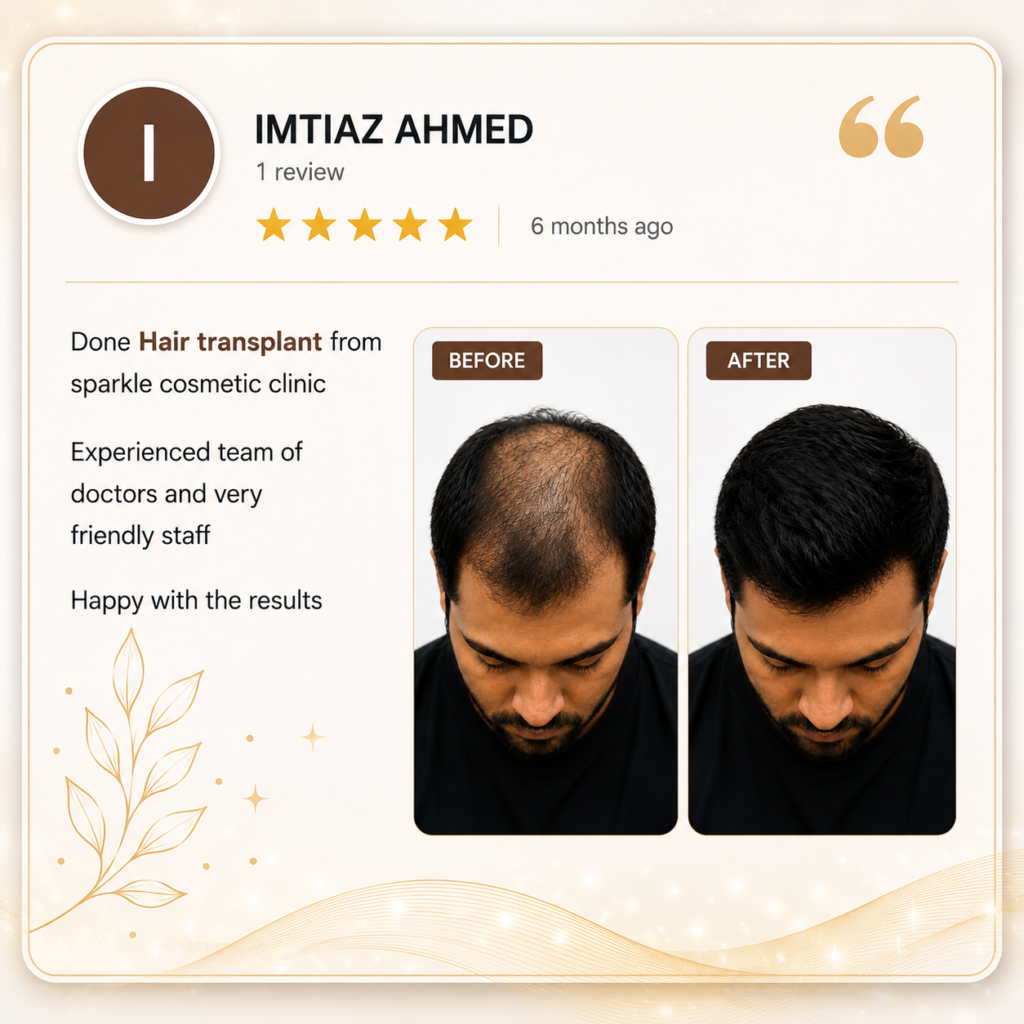 hair transplant real result