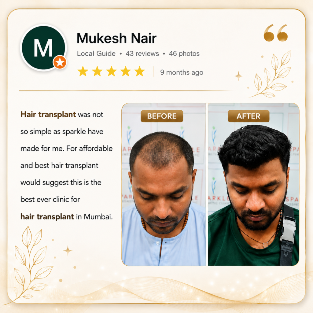 hair transplant real result