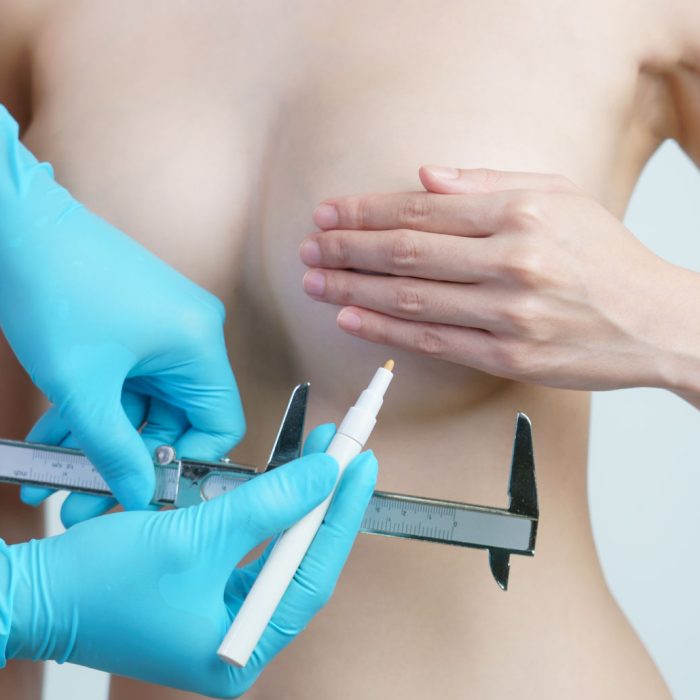 Breast Reduction in Mumbai