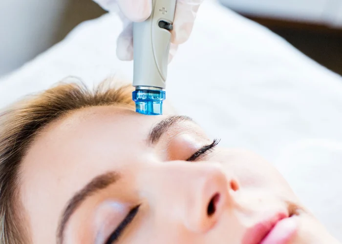 hydrafacial-treatment